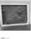 Fig. 08 - SYSTEM AND METHOD FOR AIR FILTRATION AND THERAPEUTIC RELIEF