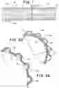 Fig. 02 - Catheter with textured surface