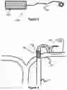 Fig. 04 - System And Method For Treatment Via Bodily Drainage Or Injection