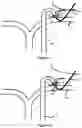 Fig. 07 - System And Method For Treatment Via Bodily Drainage Or Injection