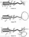 Fig. 09 - System And Method For Treatment Via Bodily Drainage Or Injection
