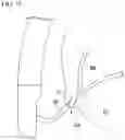 Fig. 12 - METHOD FOR FORMING ACCESS ROUTE TO BILE DUCT