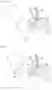 Fig. 15 - METHOD FOR FORMING ACCESS ROUTE TO BILE DUCT