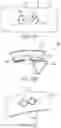 Fig. 15 - Surgical method, device, system and kit for the treatment of hydrocephalus