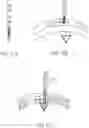 Fig. 19 - Surgical method, device, system and kit for the treatment of hydrocephalus