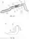 Fig. 30 - Surgical method, device, system and kit for the treatment of hydrocephalus