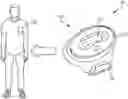Fig. 01 - Systems and Methods for Musculoskeletal Tissue Treatment
