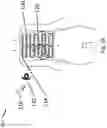 Fig. 04 - Insulated electrode for delivering tumor treating electromagnetic fields