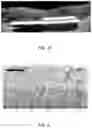 Fig. 06 - Honeycomb-shaped electro-neural interface for retinal prosthesis