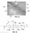 Fig. 11 - Implantable Tissue Stimulator and Method of Use