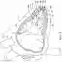 Fig. 02 - Delivery devices and methods for leadless cardiac devices