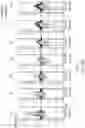 Fig. 30 - Systems and methods for optimizing implantable medical device characteristics using data structures and graphical representations