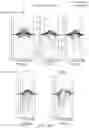 Fig. 37 - Systems and methods for optimizing implantable medical device characteristics using data structures and graphical representations