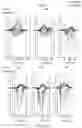 Fig. 40 - Systems and methods for optimizing implantable medical device characteristics using data structures and graphical representations