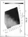 Fig. 51 - Systems and methods for optimizing implantable medical device characteristics using data structures and graphical representations