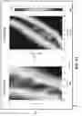Fig. 52 - Systems and methods for optimizing implantable medical device characteristics using data structures and graphical representations