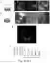 Fig. 11 - NEURONAL STIMULATION MODEL, DEVICE AND METHODS USING ALTERNATE CURRENT