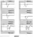 Fig. 06 - Method and apparatus for application of a neural stimulus