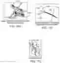 Fig. 20 - STIMULATION APPARATUS