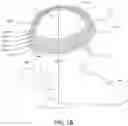 Fig. 03 - MAGNETIC STIMULATION COILS AND FERROMAGNETIC COMPONENTS FOR REDUCED SURFACE STIMULATION AND IMPROVED TREATMENT DEPTH