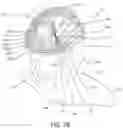 Fig. 05 - MAGNETIC STIMULATION COILS AND FERROMAGNETIC COMPONENTS FOR REDUCED SURFACE STIMULATION AND IMPROVED TREATMENT DEPTH