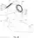 Fig. 07 - MAGNETIC STIMULATION COILS AND FERROMAGNETIC COMPONENTS FOR REDUCED SURFACE STIMULATION AND IMPROVED TREATMENT DEPTH