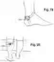 Fig. 08 - MODULE AND DEVICE FOR TREATING SYMPTOMS OF FIBROMYALGIA USING EMITTING ELECTROMAGNETIC WAVES