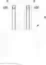 Fig. 01 - OPTICAL GUIDE FOR RHINITIS TREATMENT DEVICE
