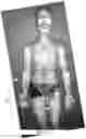 Fig. 34 - Device for delivering precision phototherapy