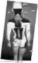 Fig. 36 - Device for delivering precision phototherapy
