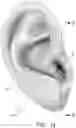 Fig. 02 - EXTERNAL AUDITORY CANAL PHOTOBIOMODULATION AND AUDIO THERAPY DEVICE