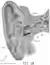 Fig. 03 - EXTERNAL AUDITORY CANAL PHOTOBIOMODULATION AND AUDIO THERAPY DEVICE