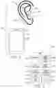 Fig. 06 - EXTERNAL AUDITORY CANAL PHOTOBIOMODULATION AND AUDIO THERAPY DEVICE