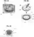 Fig. 05 - SYSTEM FOR BRACHYTHERAPY