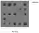 Fig. 13 - System and method for radiotherapy field delivery time optimization