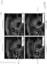 Fig. 15 - Registration free automatic contour adaptation using neural networks