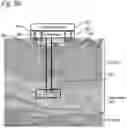 Fig. 04 - Fat tissue treatment