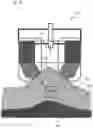 Fig. 14 - Fat tissue treatment