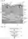 Fig. 21 - Fat tissue treatment