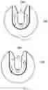 Fig. 11 - Weight adjustable dumbbell