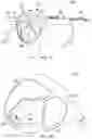 Fig. 17 - Golf club