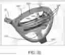 Fig. 35 - Golf club