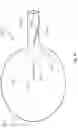 Fig. 07 - Balloon containment device