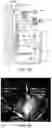 Fig. 11 - METHODS AND SYSTEMS FOR MICROFLUIDIC SCREENING