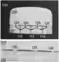 Fig. 01 - Injection molded caps or closures, and methods thereof
