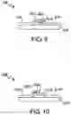 Fig. 06 - Burn-off protective coating