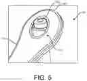 Fig. 08 - Marker opener