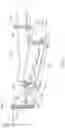 Fig. 07 - Weight distributing trailer hitch