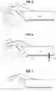 Fig. 04 - WINCH BAR AND RELATED WINCH SYSTEM
