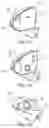 Fig. 02 - External rearview device, external rearview device kit and vehicle